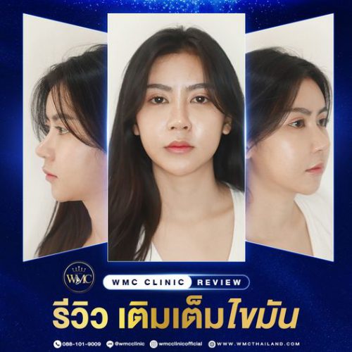 332735104_3323709324552677_5139512070454783836_n