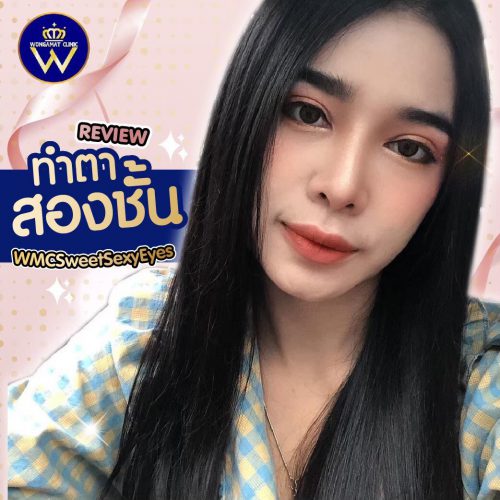 LINE_ALBUM_ตาสองชั้น-ก่อน-หลัง_220629