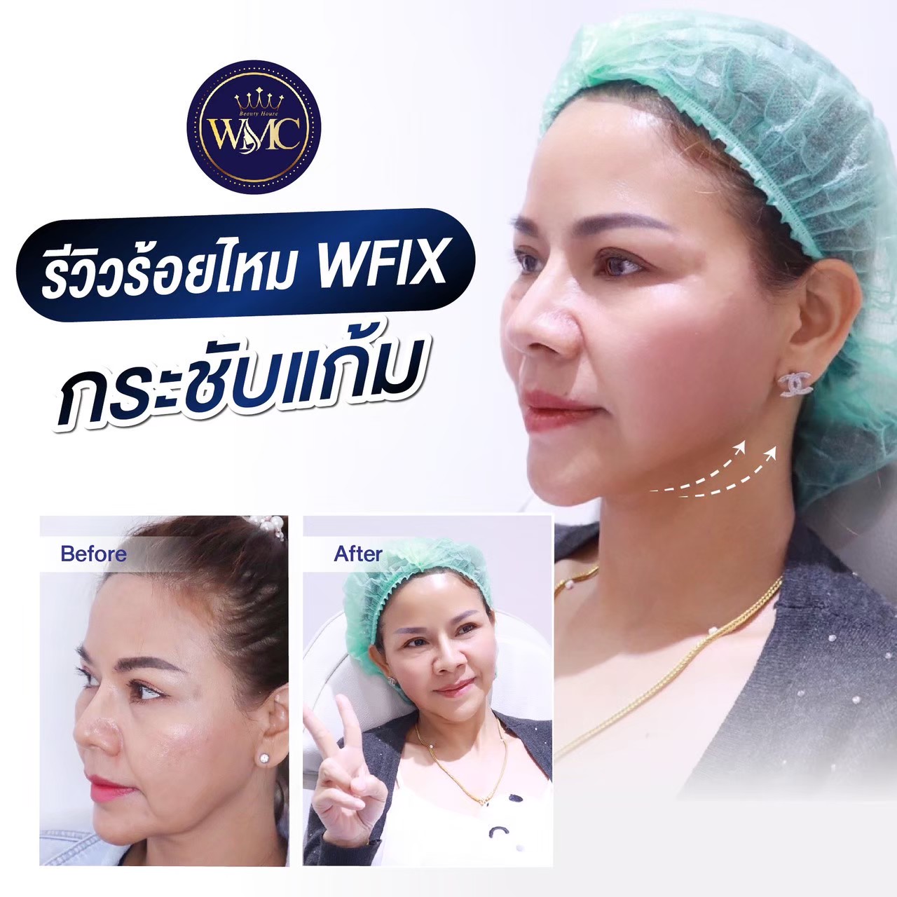 LINE_ALBUM_รีวิวร้อยไหม_220724_16