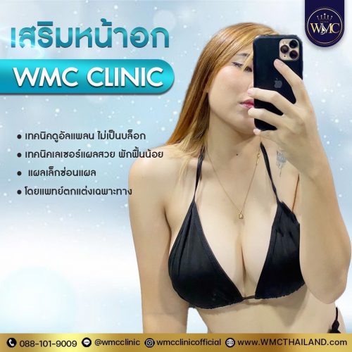 Breast augmentation (5)