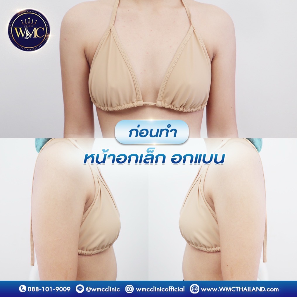 line_oa_chat_250423_081854