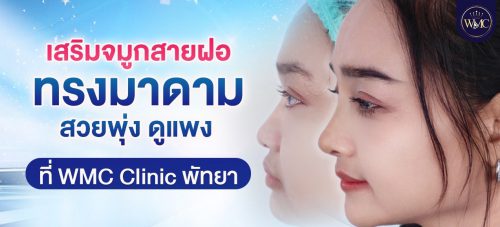 เสริมจมูก พัทยา ทรงมาดาม WMC Clinic