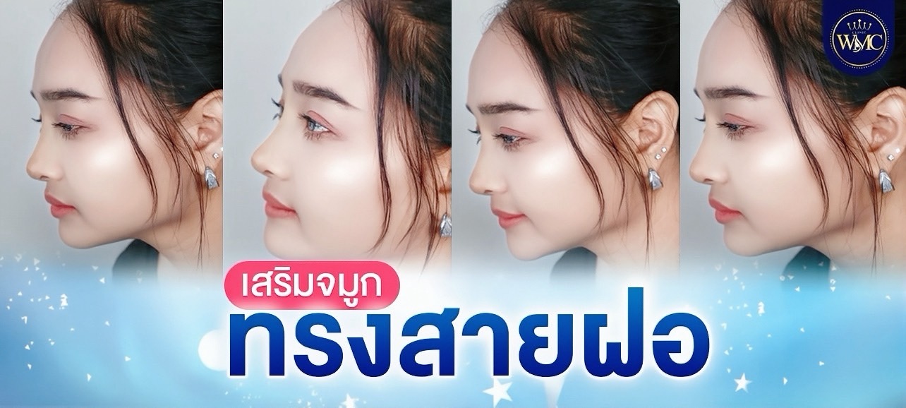 เสริมจมูก พัทยา ทรงมาดาม WMC Clinic