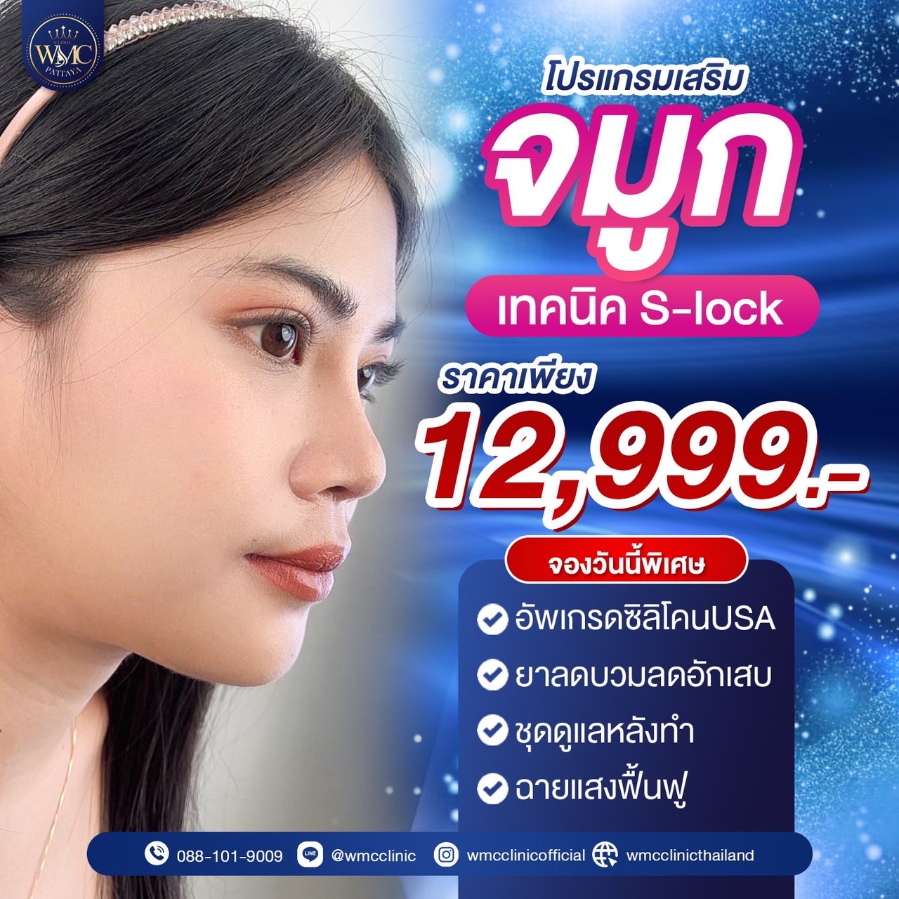 เสริมจมูก พัทยา ทรงมาดาม WMC Clinic