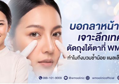 ตัดถุงใต้ตา