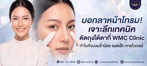 ตัดถุงใต้ตา