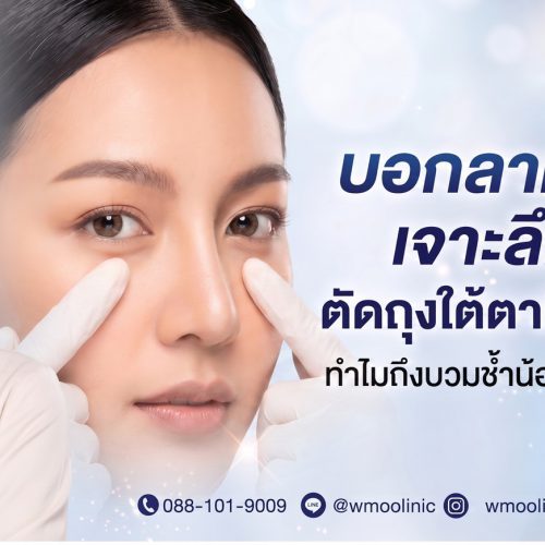 ตัดถุงใต้ตา