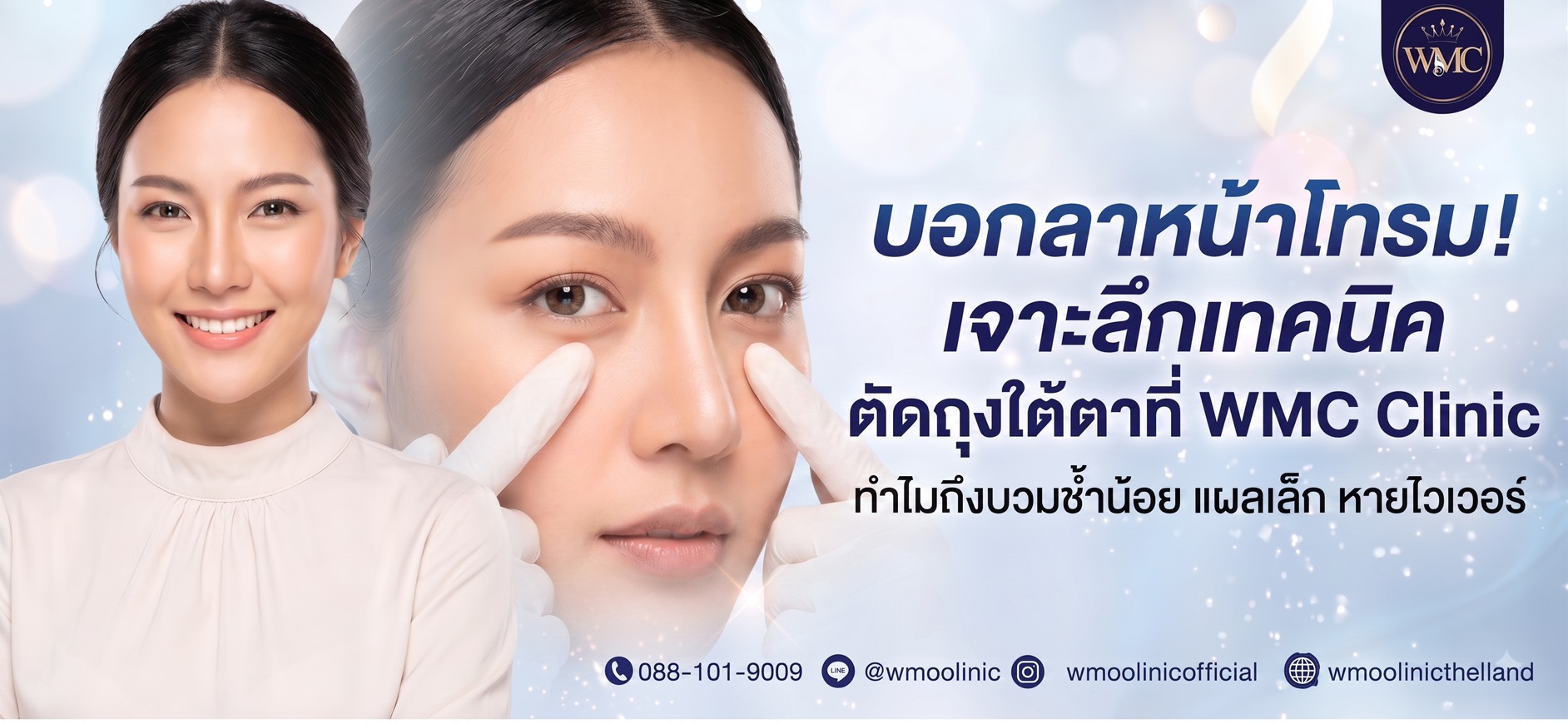 ตัดถุงใต้ตา