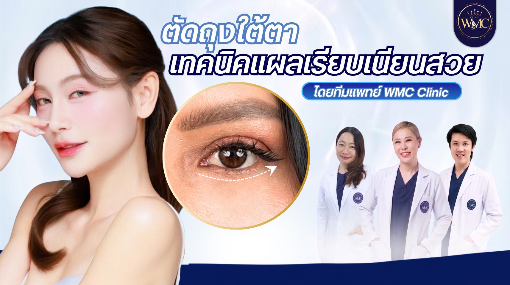 ตัดถุงใต้ตา