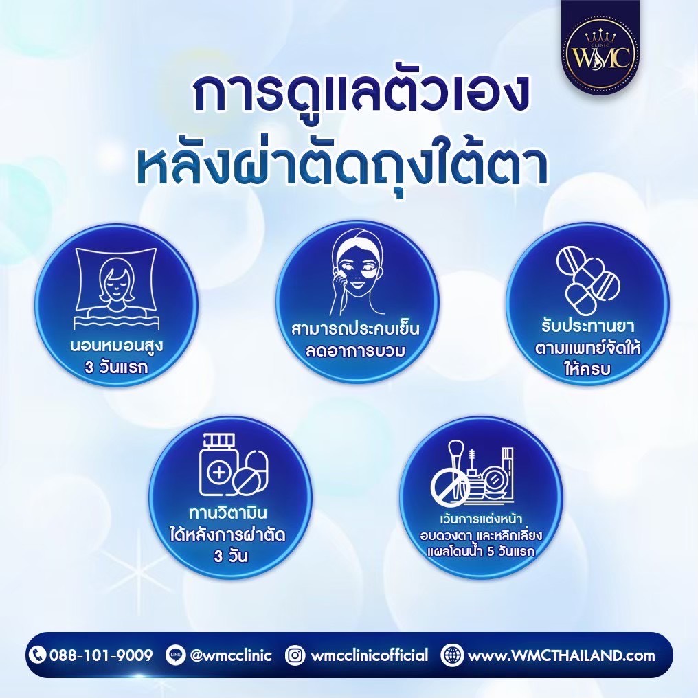 ตัดถุงใต้ตา